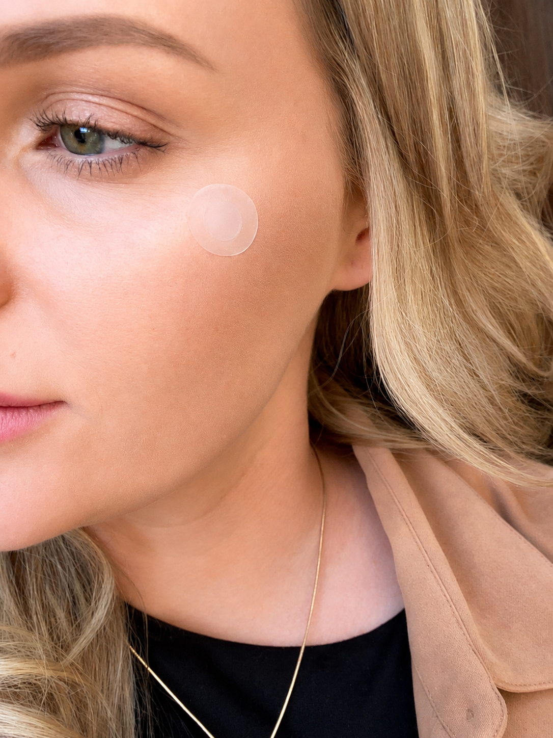 Microneedle Acne Patches